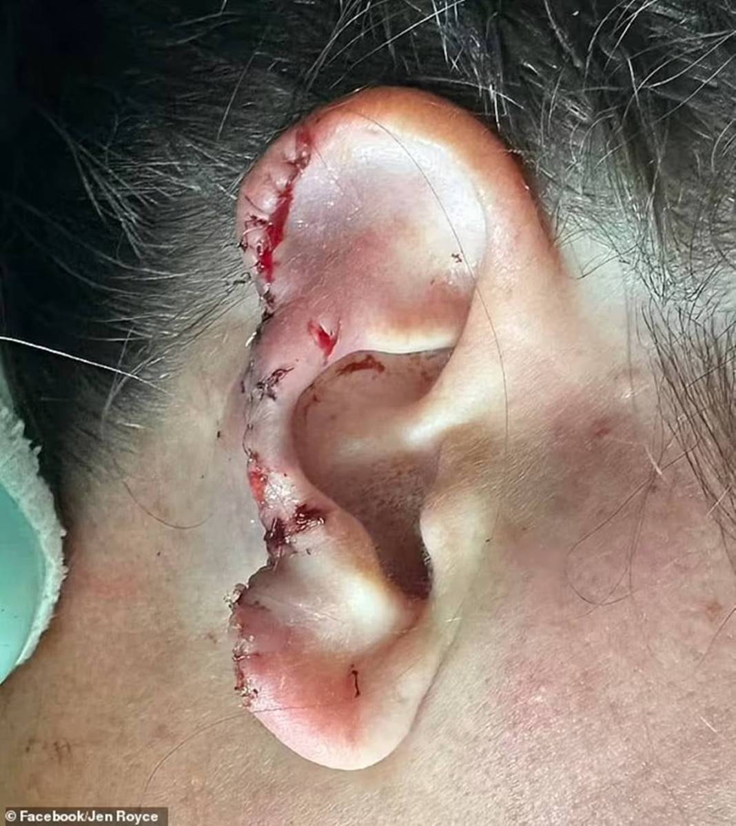 Nehre girdi, kanlar içinde çıktı! O canavar yüzünü paramparça etti... Arkasından usulca gelip... 3